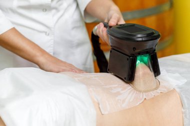 depositphotos 302232628 stock photo cryolipolysis fat freezing treatment weight