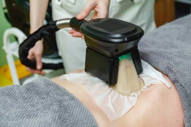 depositphotos 354581152 stock photo woman getting cryolipolysis fat treatment